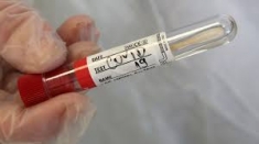 Дестинации за пътуване без PCR тест